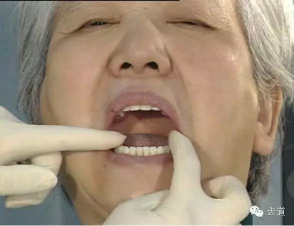 5.webp.jpg 5.webp.jpg