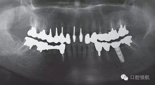 640.webp (2).jpg 640.webp (2).jpg