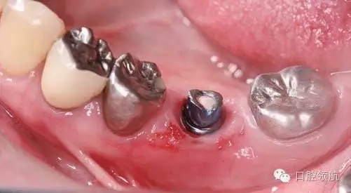 640.webp (5).jpg 640.webp (5).jpg