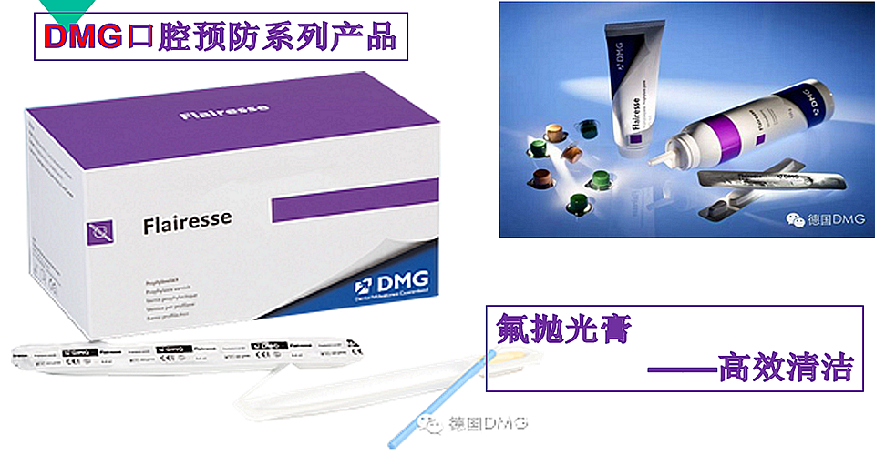 DMG预防产品/氟抛光膏